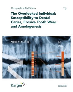 El individuo ignorado: susceptibilidad a la caries dental, desgaste erosivo dental y la amelogénesis