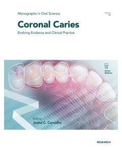 Caries coronales