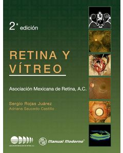 Retina y vítreo